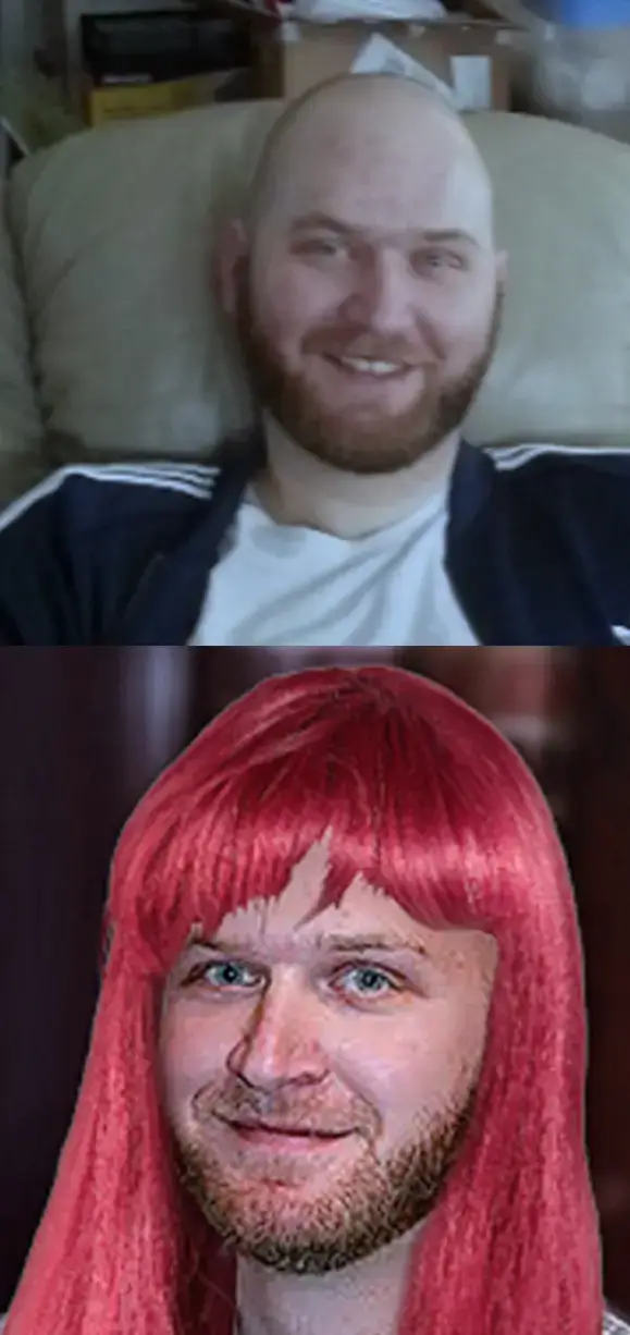 kyle bald and kyle with long hair